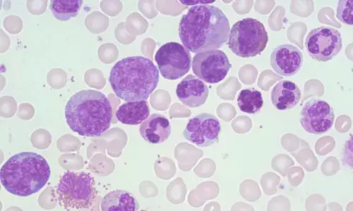 CML Treatment Goals Are Evolving: Why Deeper Responses and Quality of Life Matter More Than Ever