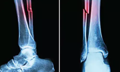 NIT Rourkela study to boost bone regeneration technology