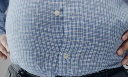 The Semaglutide revolution: Transforming obesity medicine