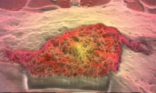 Study: Problems with brain’s waste clearance can contribute to dementia