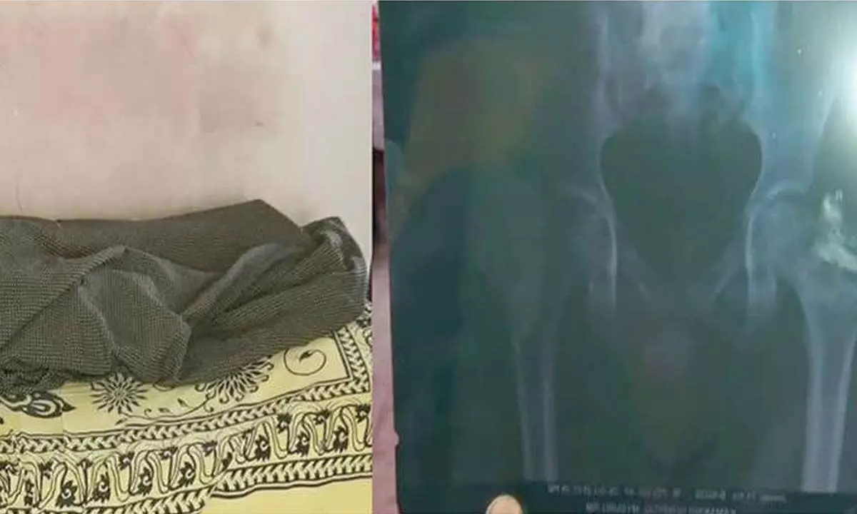 Class 8 student assaulted by classmates, undergoes surgery Class 8 student assaulted by classmates, undergoes surgery