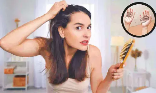 Breaking the myths: Why hair fall isn’t always about the shampoo you use