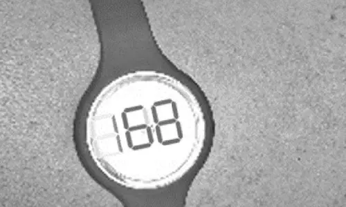 IIT Madras unveils low-cost, minimally invasive glucose monitor IIT Madras unveils low-cost, minimally invasive glucose monitor