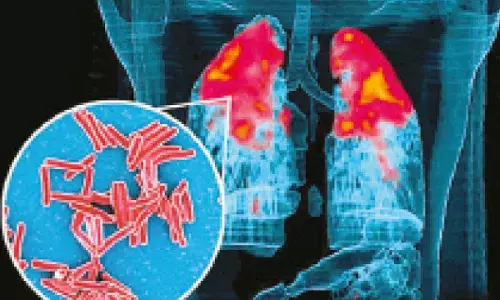 IIT Bombay study shows how TB bacteria shield themselves from antibiotics, stay alive longer