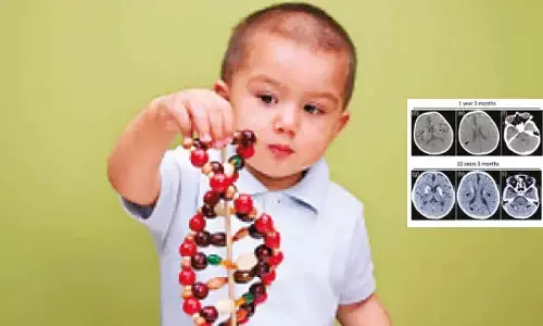 Researchers find rare gene mutation linked to recurrent neurological decline in children