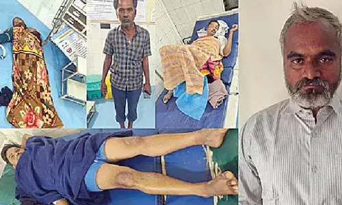 Man attempts to burn wife, her family alive Man attempts to burn wife, her family alive