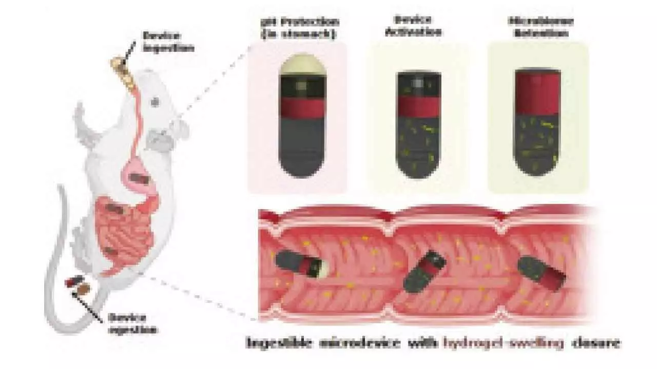 IIT Delhi, AIIMS’s new ingestible device can collect microbial samples from small intestine IIT Delhi, AIIMS’s new ingestible device can collect microbial samples from small intestine