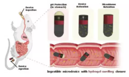 IIT Delhi, AIIMS’s new ingestible device can collect microbial samples from small intestine IIT Delhi, AIIMS’s new ingestible device can collect microbial samples from small intestine