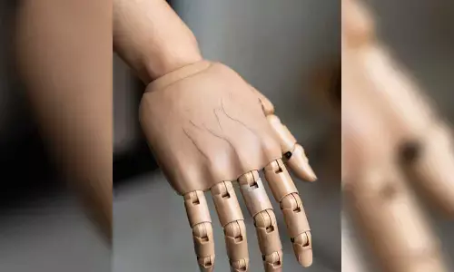 Waiting for ‘new arm’, Keralas 9-year-old Vinodini holding on to her dream