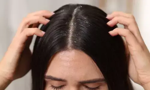 Winter Haircare Mistakes That Slowly Damage Your Hair Winter Haircare Mistakes That Slowly Damage Your Hair