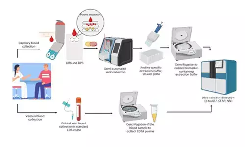 At-home blood tests can accurately detect key biomarkers of Alzheimers