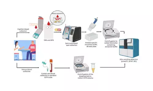 Simple blood test may spot Alzheimer’s early: Study Simple blood test may spot Alzheimer’s early: Study