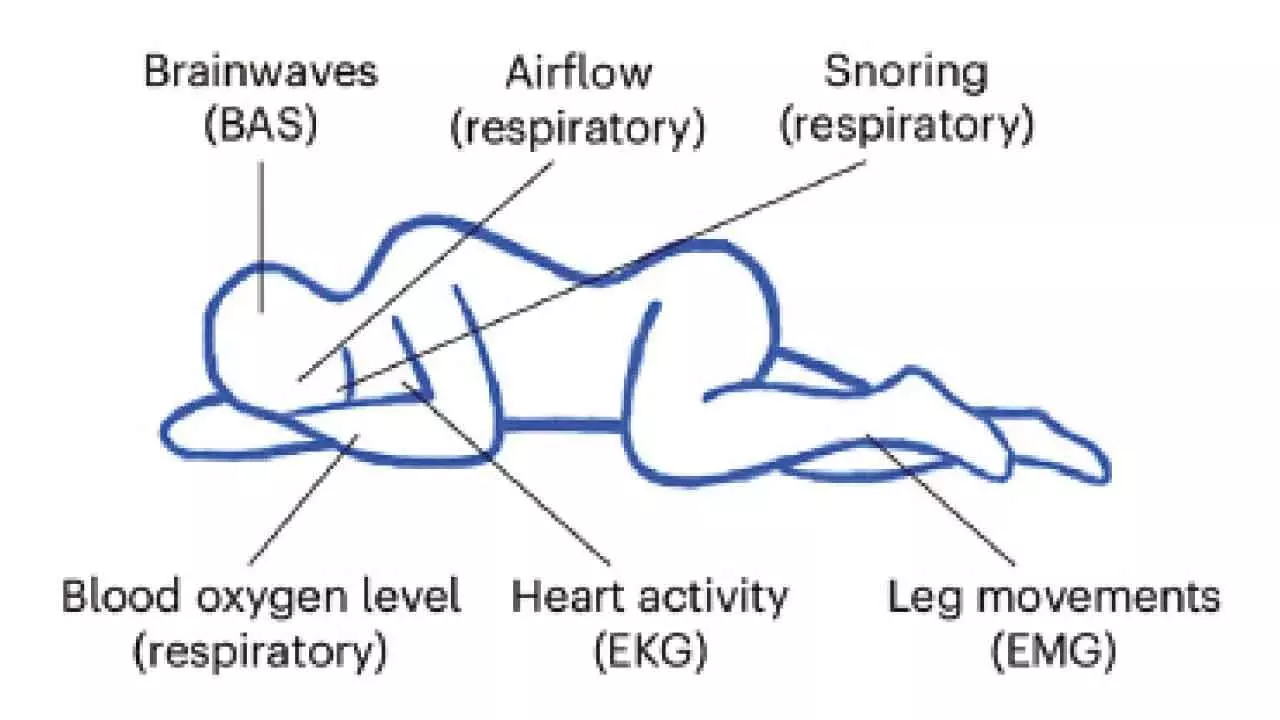 Researchers develop AI that predicts disease risk from sleep data Researchers develop AI that predicts disease risk from sleep data