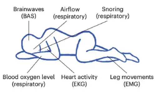 Researchers develop AI that predicts disease risk from sleep data Researchers develop AI that predicts disease risk from sleep data