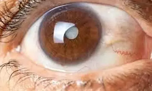 Widespread steroid use emerging as a key trigger for secondary glaucoma, warn doctors