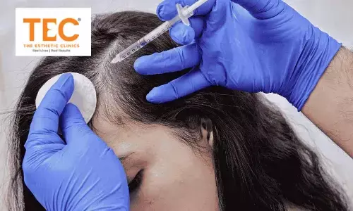 Best Hair Treatment in Bangalore: When Burnout Shows Up on the Scalp