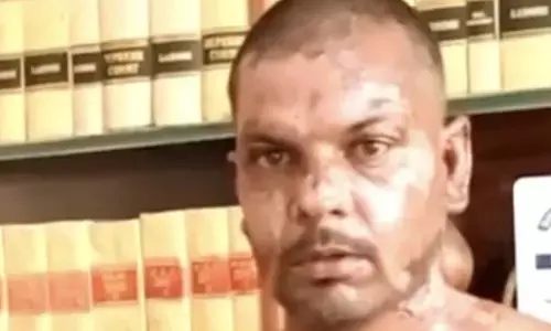 Rights group condemns brutal attack on Christian man in Pakistan