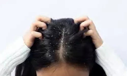 Small Haircare Tweaks That Can Help Prevent Dryness, Dandruff and Hair Thinning Small Haircare Tweaks That Can Help Prevent Dryness, Dandruff and Hair Thinning