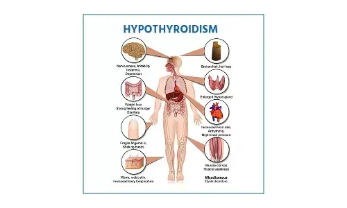 Hypothyroidism – An evidence-based approach towards it’s homeopathic management Hypothyroidism – An evidence-based approach towards it’s homeopathic management