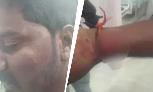 Man Assaulted In Karnataka After Being Seen With Neighbour’s Wife While Mediating Family Dispute