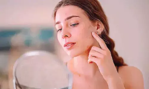 Understanding women’s most common skin concerns