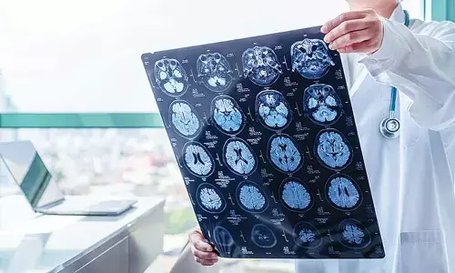 Locals claim higher toll after 7 die of liver disease in Har