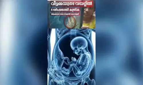 Cong leaders slam Vijayan govt over isolated incidents claim in Kerala health sector