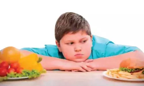 Today is World Obesity Day: How students can overcome obesity risks