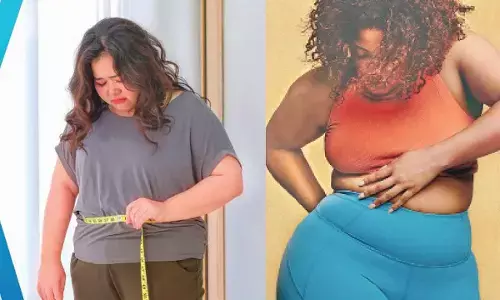 Today is world obesity day: Why obesity in women is more than just weight gain