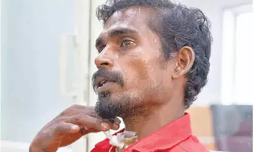 Live fish stuck in fisherman’s throat removed