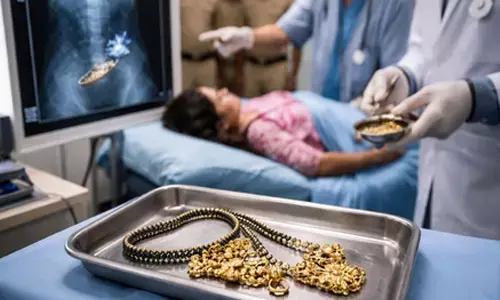 All-women gang from MP held in Rajasthan after X-ray reveals stolen jewellery