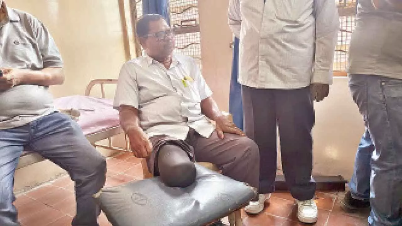 Osmania Hospital launches free 3D-printed artificial limb facility Osmania Hospital launches free 3D-printed artificial limb facility