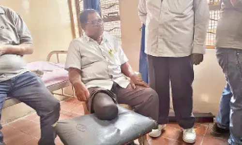 Osmania Hospital launches free 3D-printed artificial limb facility