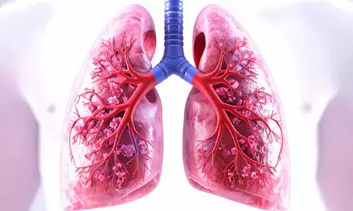 Sri Lanka reports up to 9,500 tuberculosis cases annually