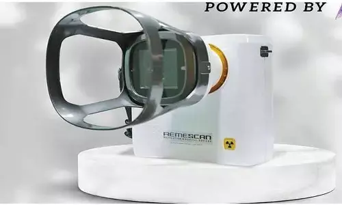 AI X-ray kits to be rolled out for 2-minute TB detection