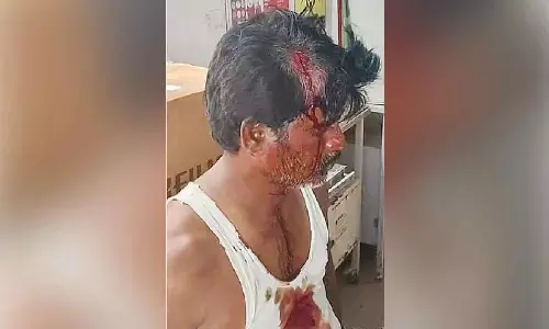 Minor dispute over drainage sparks violent clash in Kurnool Minor dispute over drainage sparks violent clash in Kurnool