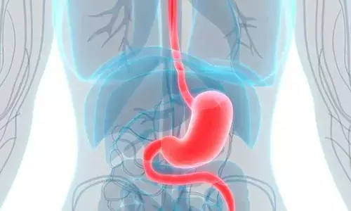 Bengalureans at risk of contracting colorectal cancer: Survey