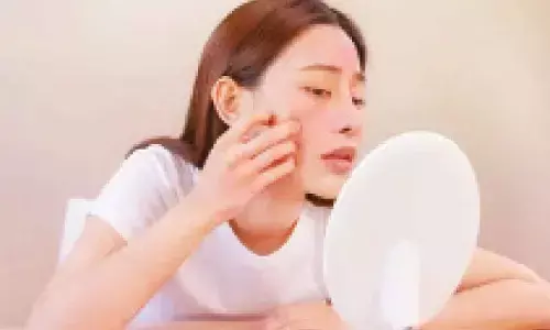 Air conditioning: How does it affect the skin?