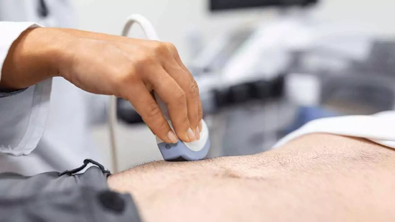 New laser system for better kidney stone management New laser system for better kidney stone management