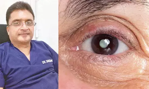 Cataract is no longer an old age disease: It’s hitting people at 40
