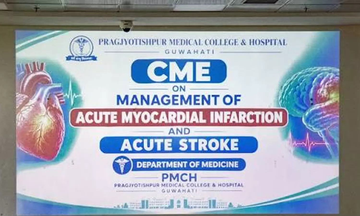 CME on stroke management tomorrow CME on stroke management tomorrow