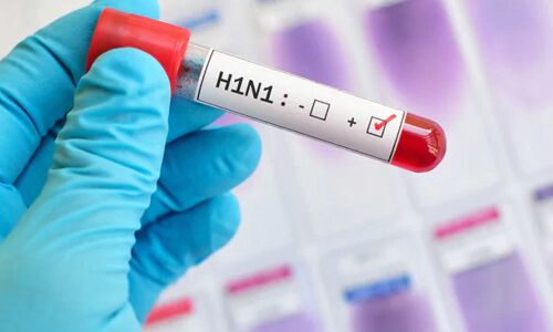 Swin flu cases mount to 2,835