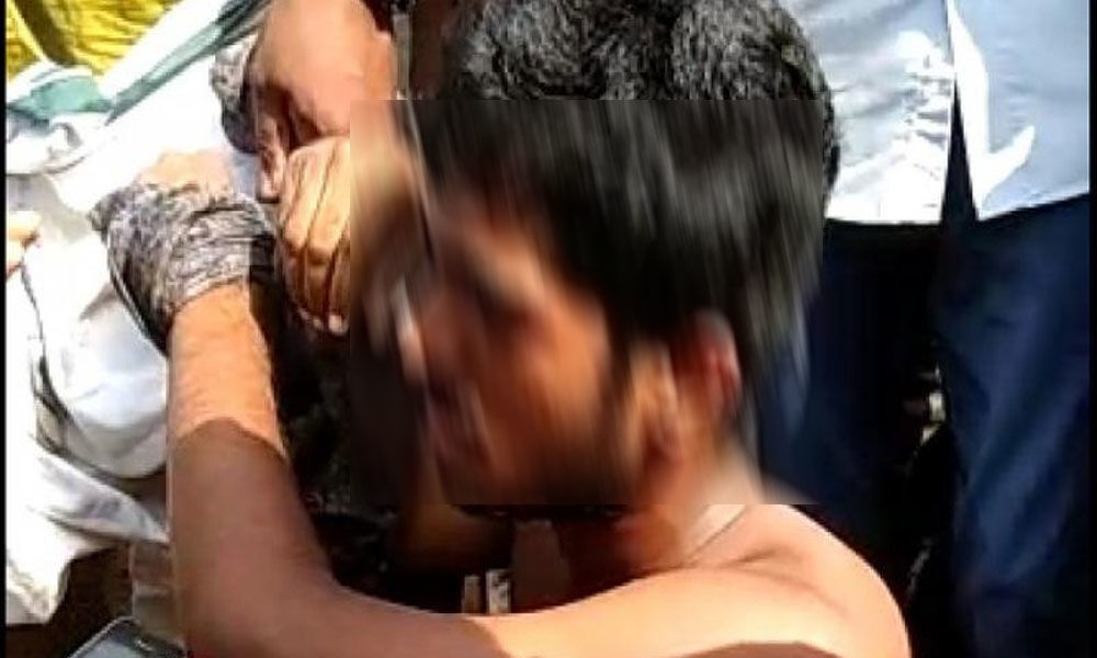 18-year old teen stalker sets girl on fire in broad daylight in Kerala