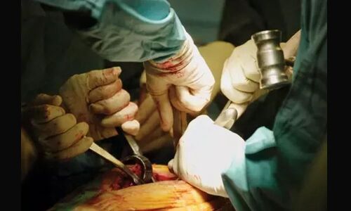 Hopeful fight by an intrepid patient in Delhi