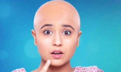 Dealing with taboo of baldness in women