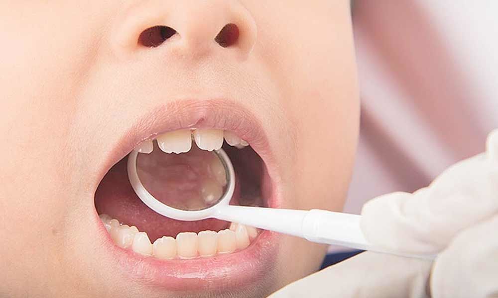 UK students to give dental aid to Indias poor