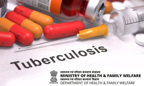 IMA to sensitise public on TB