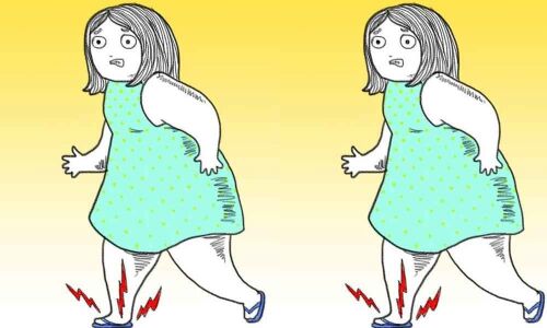 Yes, complications do arise out of walking!