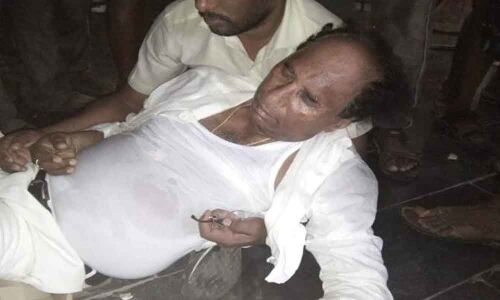 Kodela injured in attack by YSRCP activists