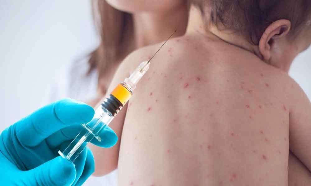 Study warns of measles outbreak